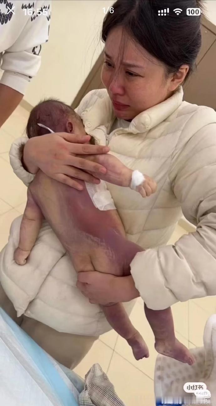 女婴疑在宁波妇幼做微创手术去世，家属称涉事医生术前告知自愈概率及手术风险低！
