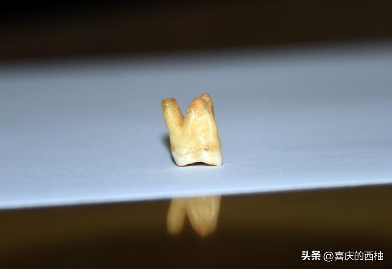 别再睡前才刷牙了！80 岁牙口好的老人，都做到了这 2 点

今天看到上说别等睡