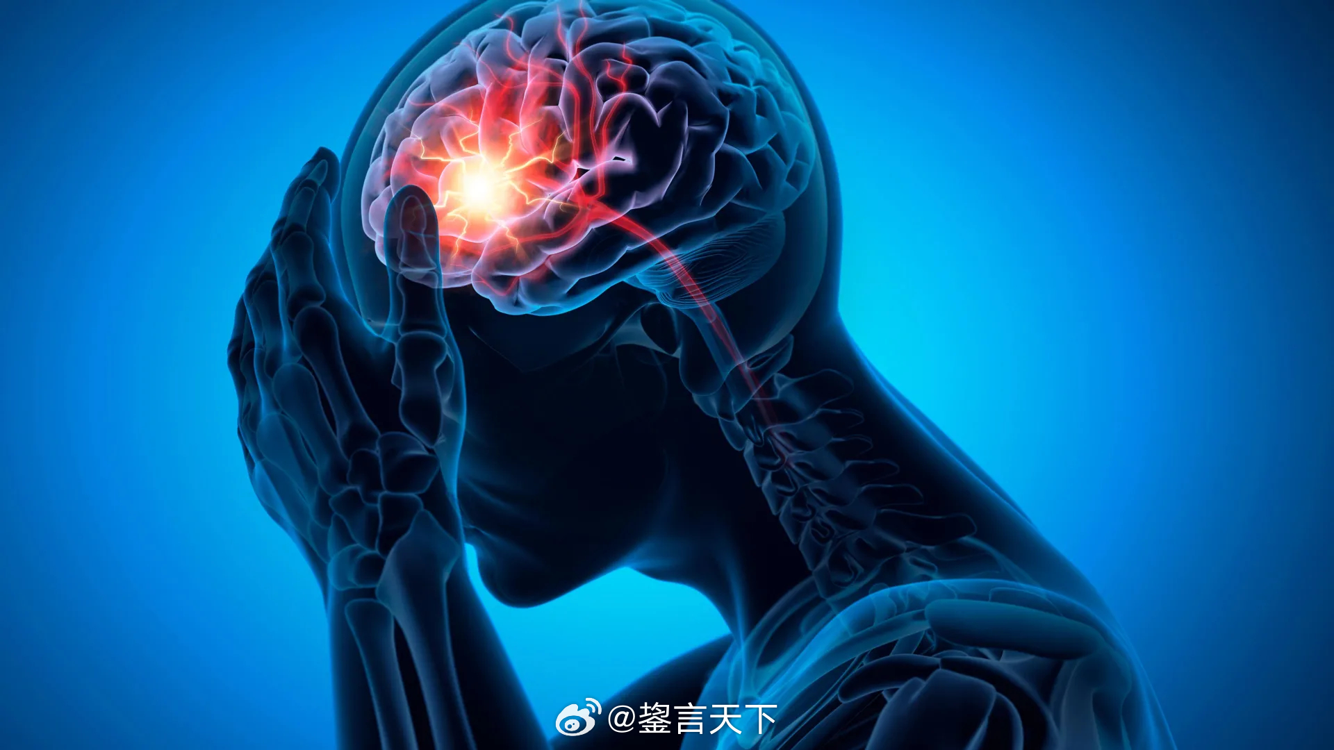 代糖赤藓糖醇erythritol 会降低身体分解血栓的能力 科罗拉多大学博尔德分