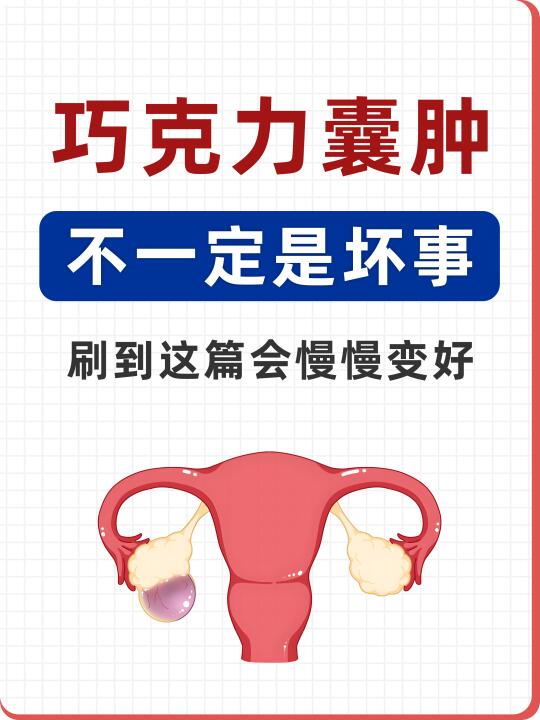 巧克力囊肿，不一定是坏事！
