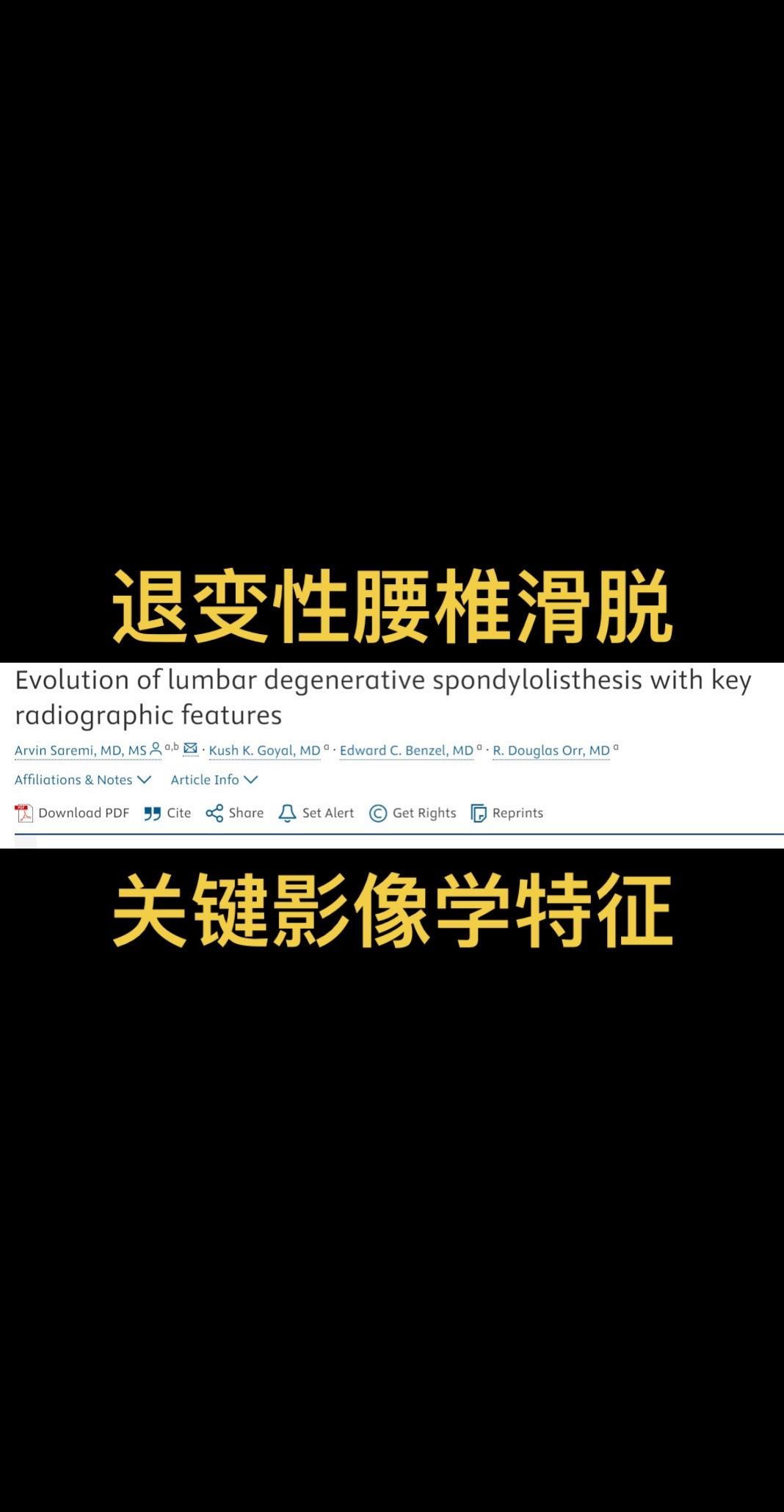 退变性腰椎滑脱影像学特征。