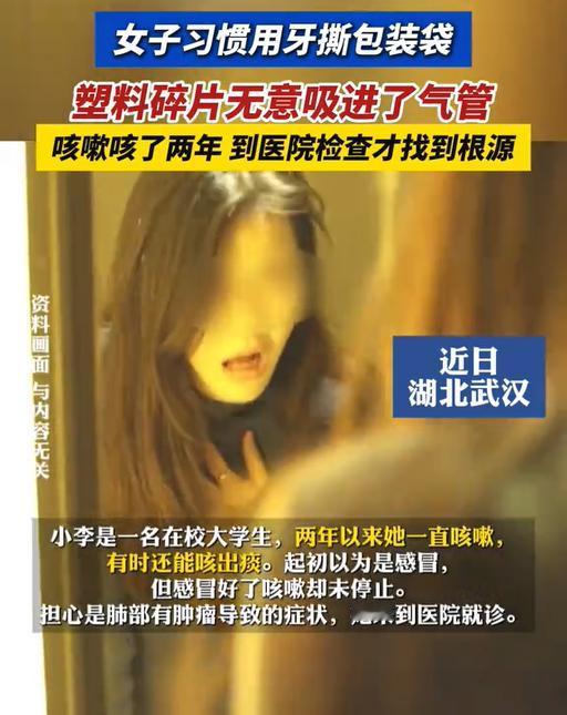 “太奇葩了！湖北一女子吃零食从不用剪刀，直接用牙齿撕包装后，无意中将吐掉的碎片吸