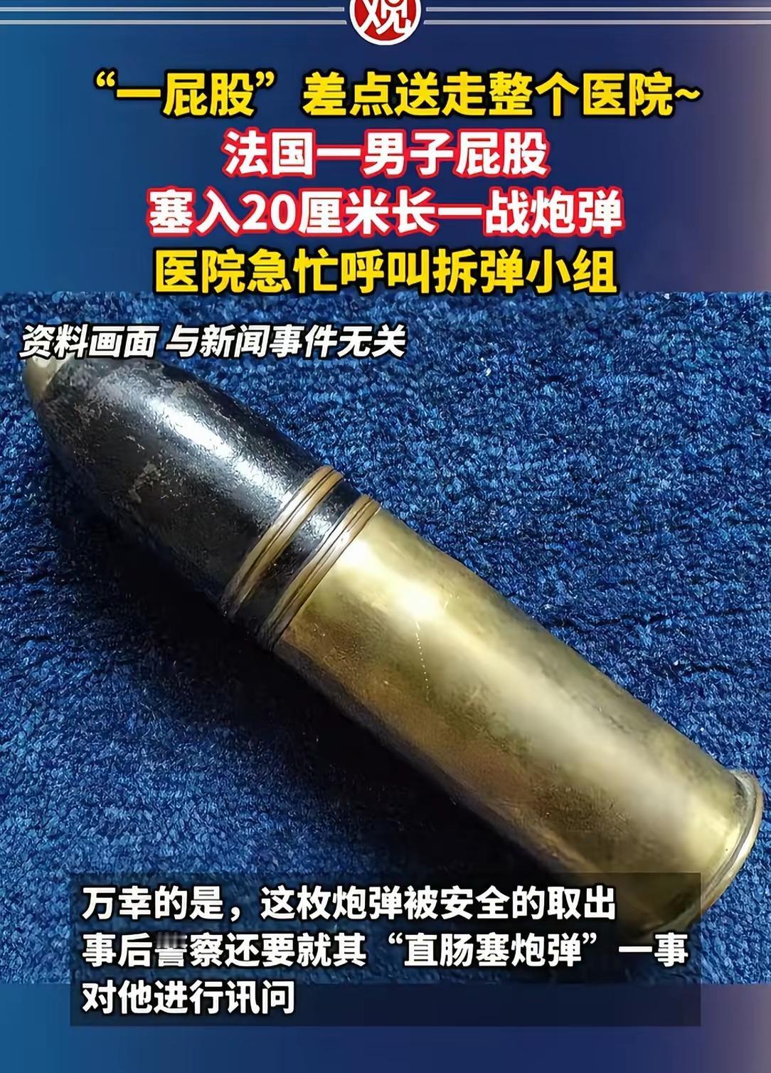 这可比留法小分队玩的野，法国狠人用一战炮弹“爆菊”，医院秒变拆弹现场。
 
当这