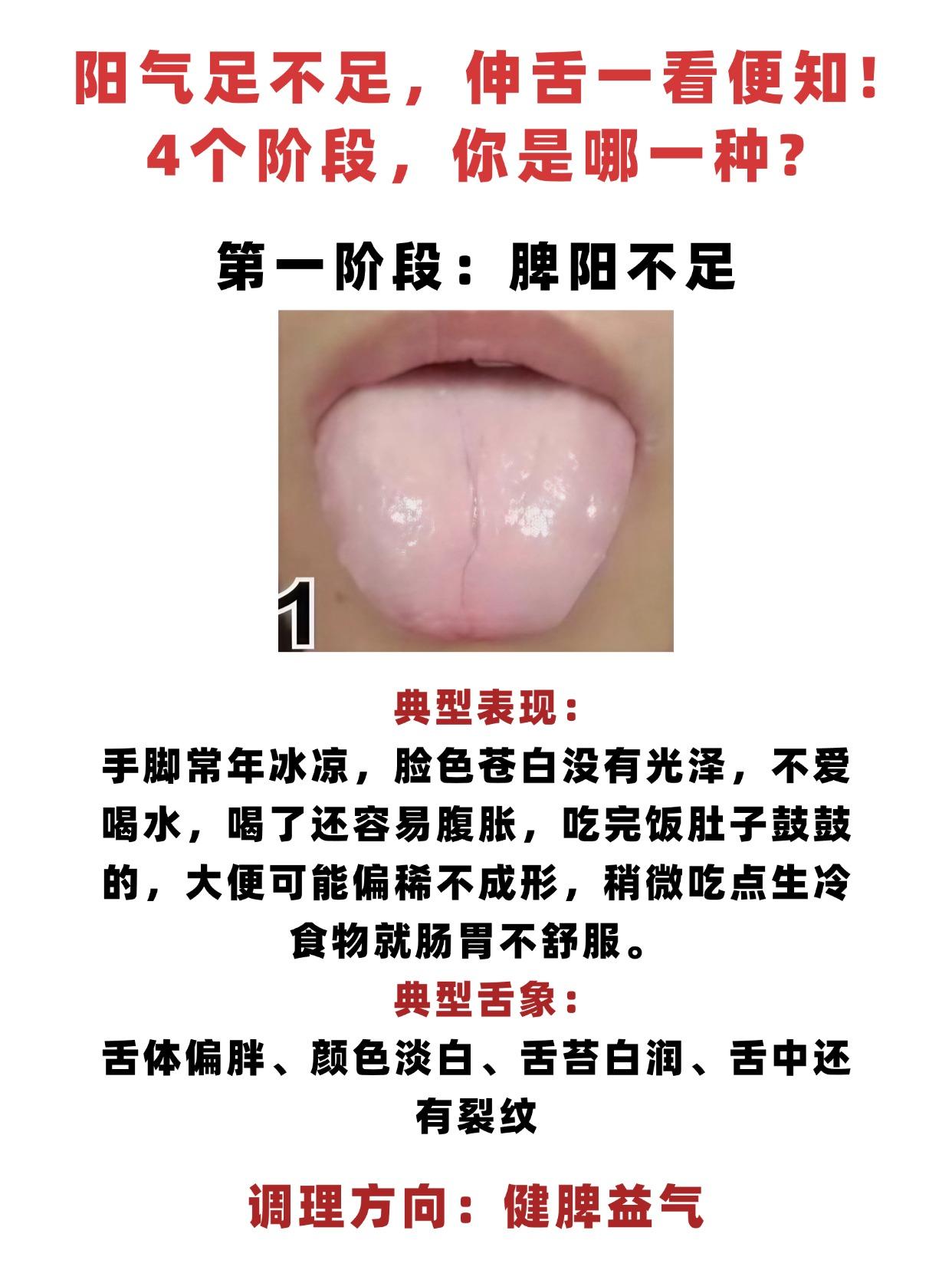 阳气足不足，伸舌一看便知！4个阶段，你是哪一种?