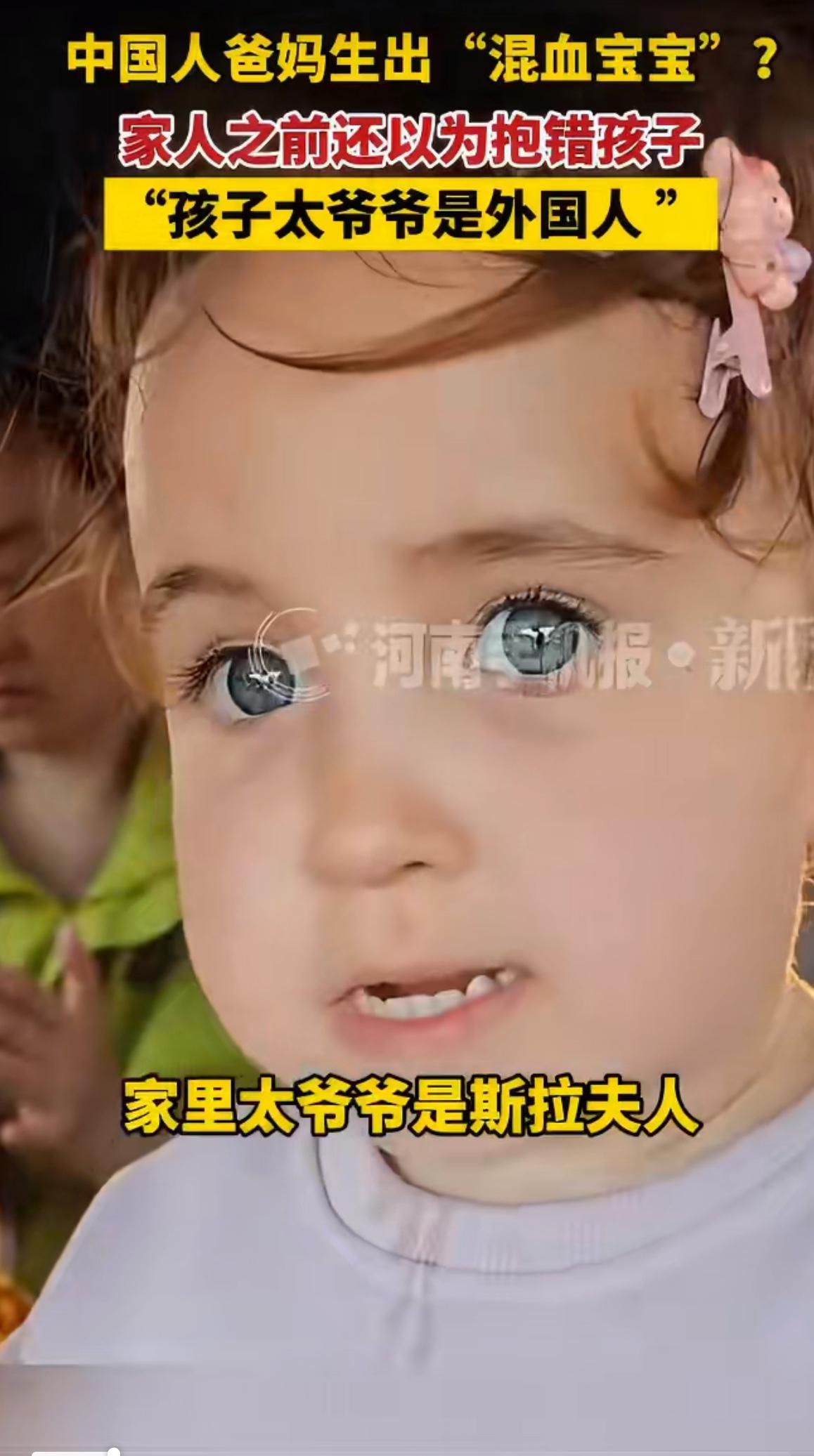 太燃了，真是让所有人
都惊掉了下巴
一对中国爸妈生了一个金发碧眼的“混血宝宝”