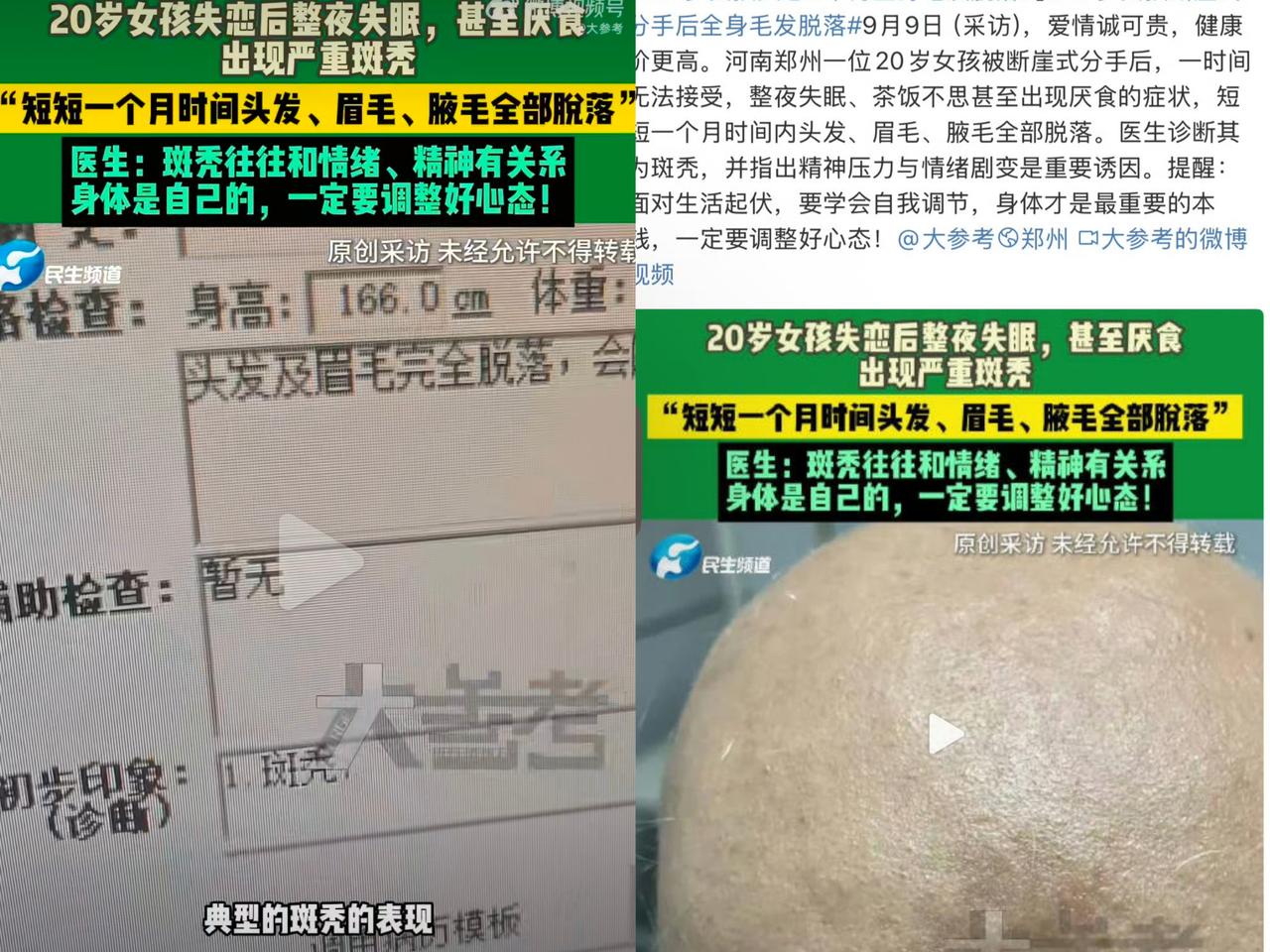 河南郑州一名20岁女孩经历“断崖式分手”后，因情绪崩溃出现整夜失眠、厌食等症状，