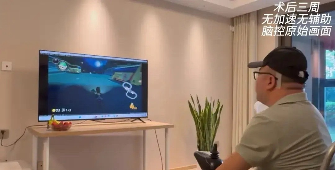 我国成功开展首例侵入式脑机接口临床试验！相关受益股会不会起飞！中科院和华山医院整
