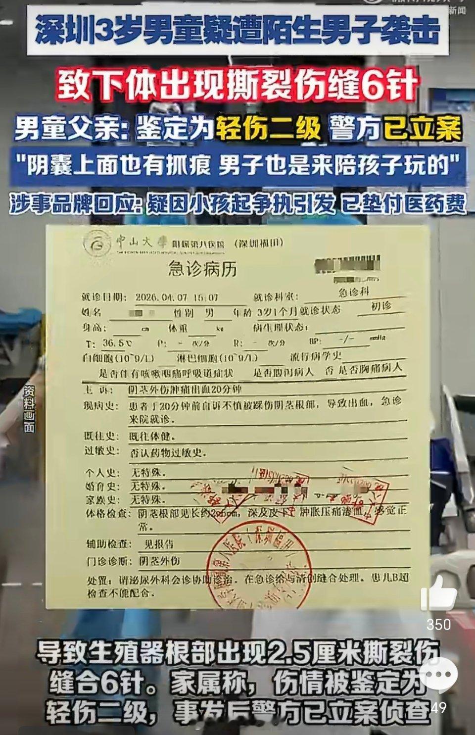 3岁男童被陌生人打致下体撕裂缝6针这是什么生物，连三岁小孩也下手，太残忍了。三岁