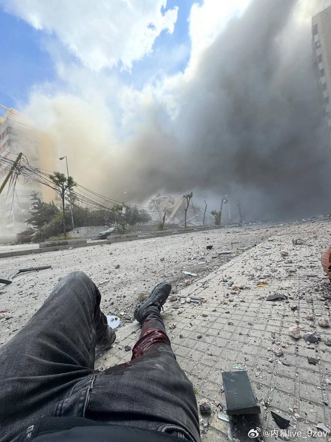 黎巴嫩《消息报》首席摄影师海瑟姆·穆萨维今天在报道以色列对贝鲁特南部郊区的袭击时