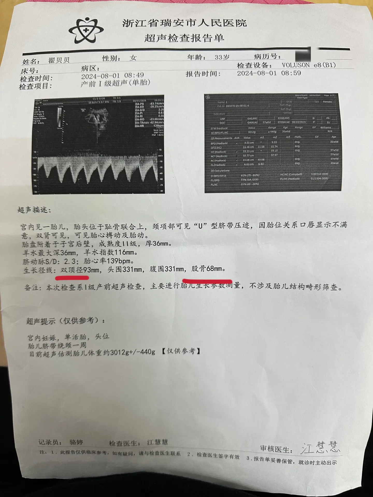 头大腿短，咱就说你爸妈的大长腿白长了吗，还有四天就足月了，足月就发动吧...