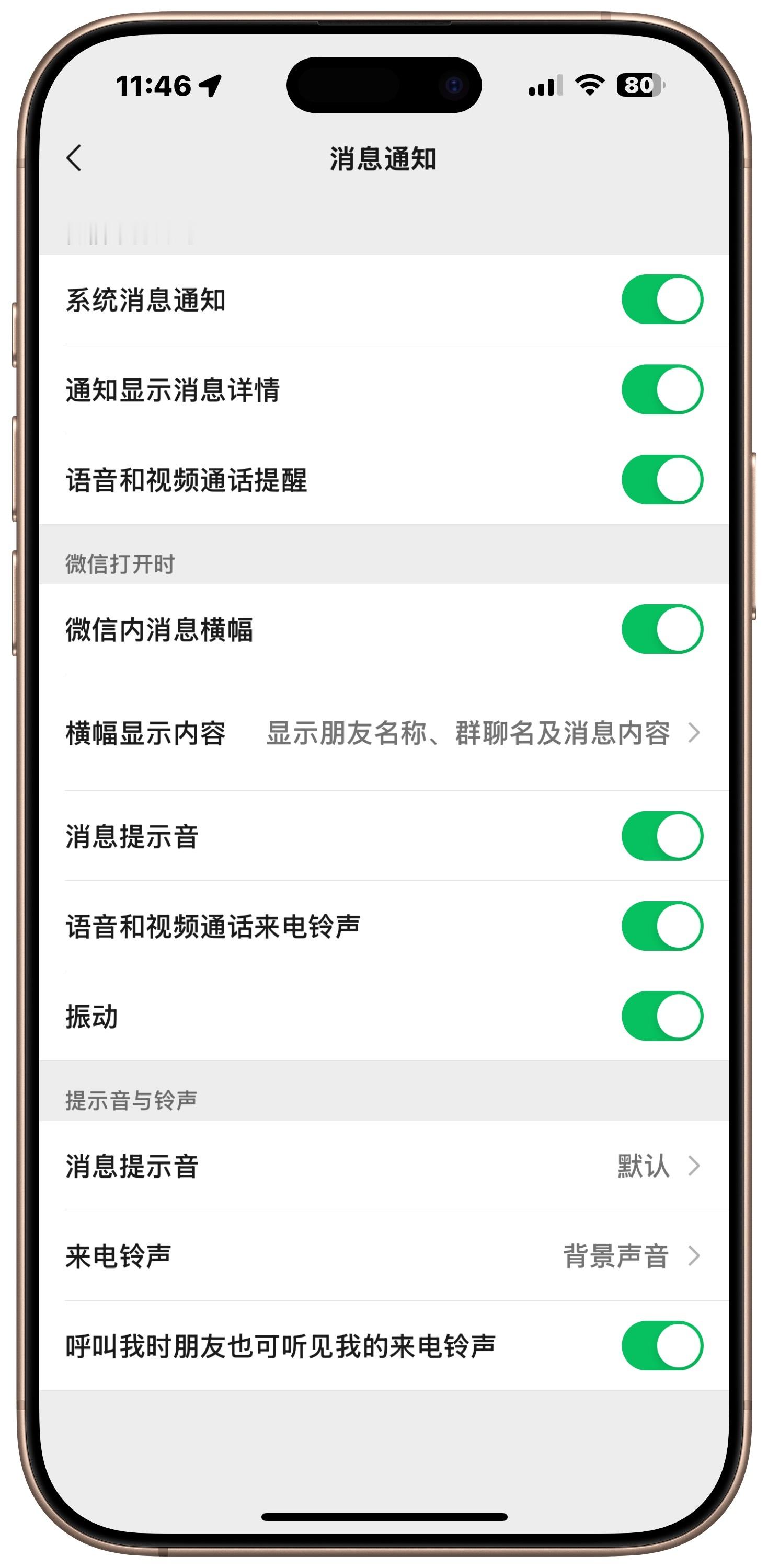 感觉大家都开通了callkit，只有我还没变化[泪] 