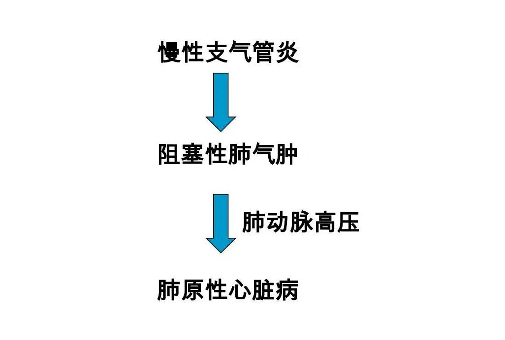 肺气肿“三部曲”是怎么回事？这个说法太形象了肺气肿是怎么回事呢？就是大气压力进到