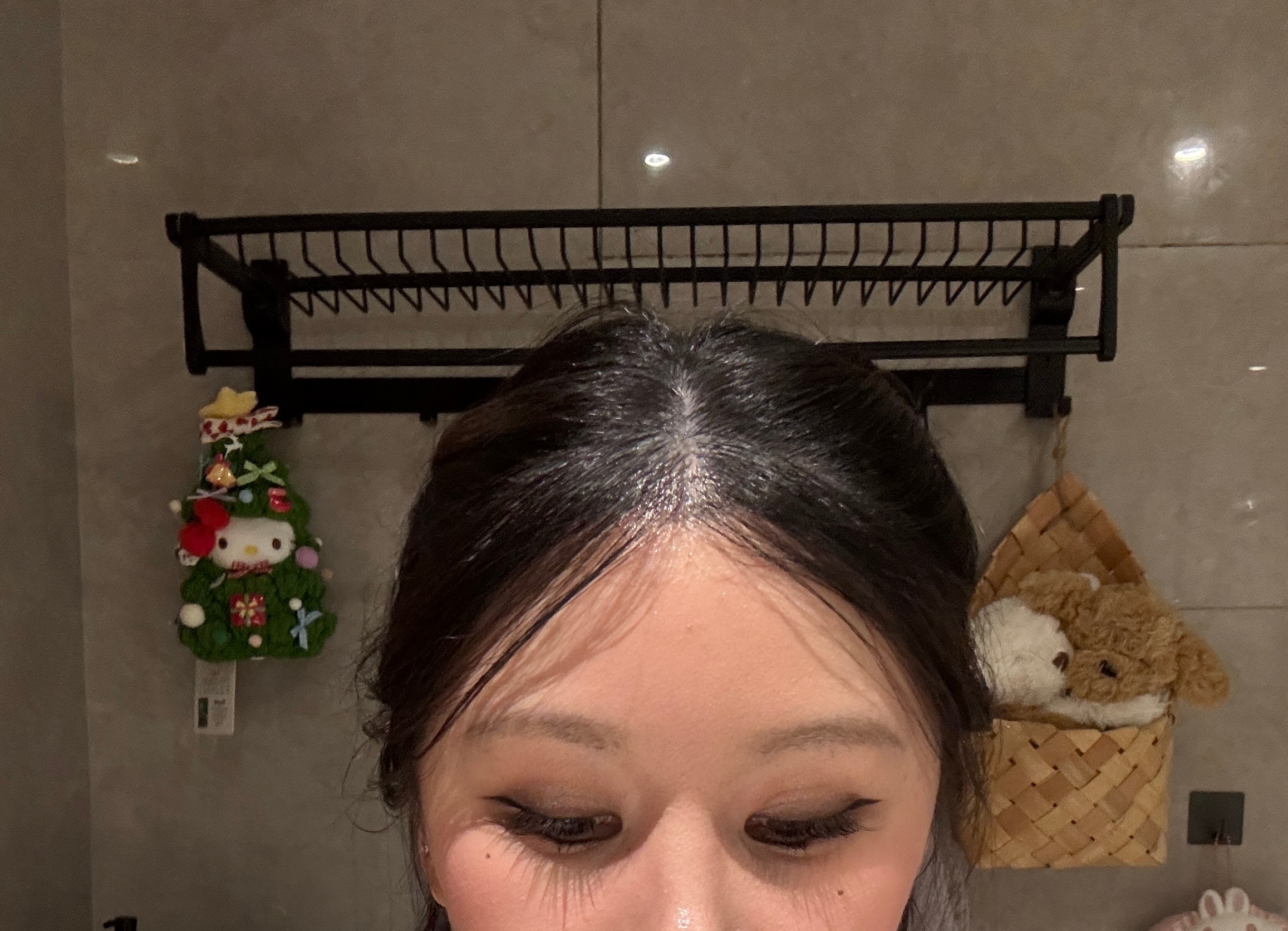 pcl打颞部第4天，我这几天一直在外面见人，今天照镜子才发现我现在像个窝瓜！！！