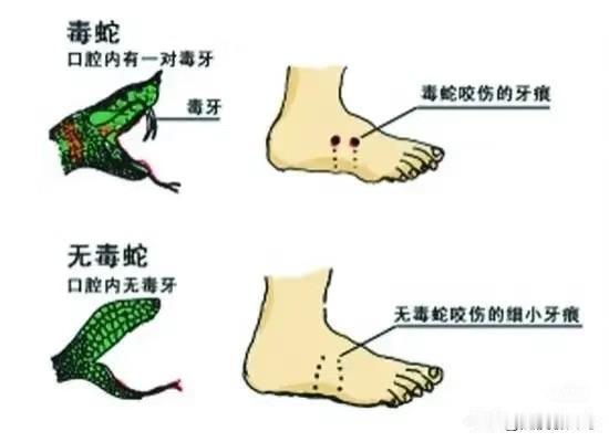 三亚游客被蛇咬，我们普通人要知道的事！
三亚的蛇也是挺罕见的，大多数人遇到的概率