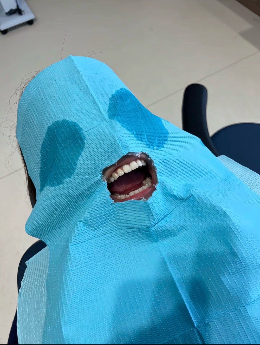 咦 已经开始牙疼了(￣口￣)!! 