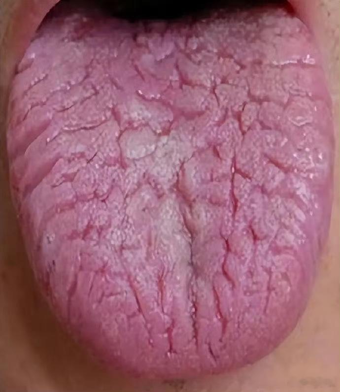 中医：凡是皮肤瘙痒，一抓就起疹者，多为血虚风燥，记好这一方！作品声明：内容仅供参