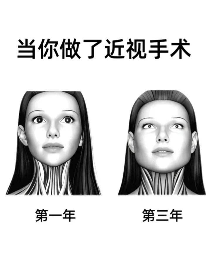 最近总是刷到“一旦你做了近视手术......”3年后脸都变型了，好吓人！弄得一直