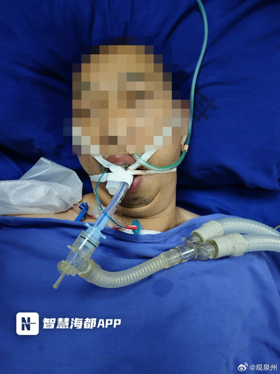 福建一学子为病危的父亲求助盼好人援手 “爸爸的手术很顺利，但目前仍在危险期，手术