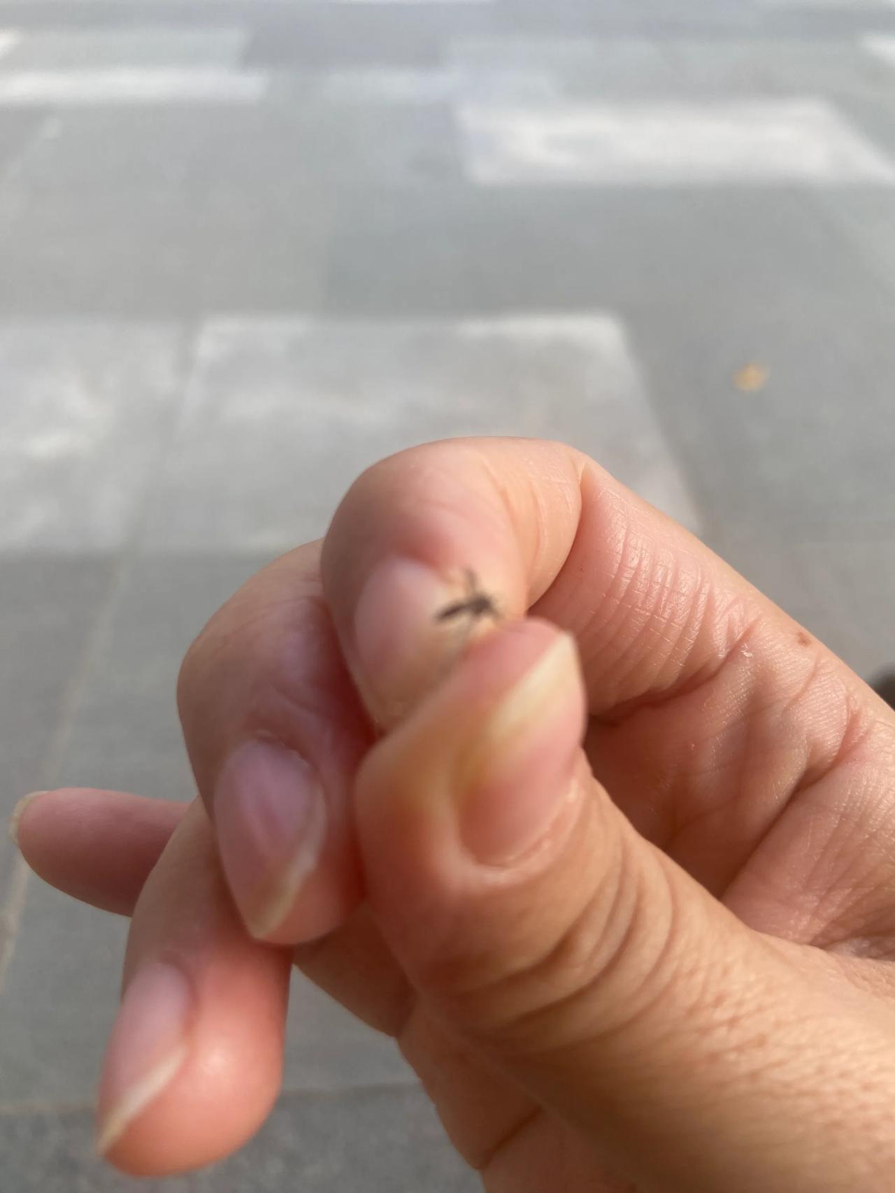 天这么凉了

蚊子🦟还很猖狂

被咬了好多包

敢吸我血

我就要你命[呲牙]