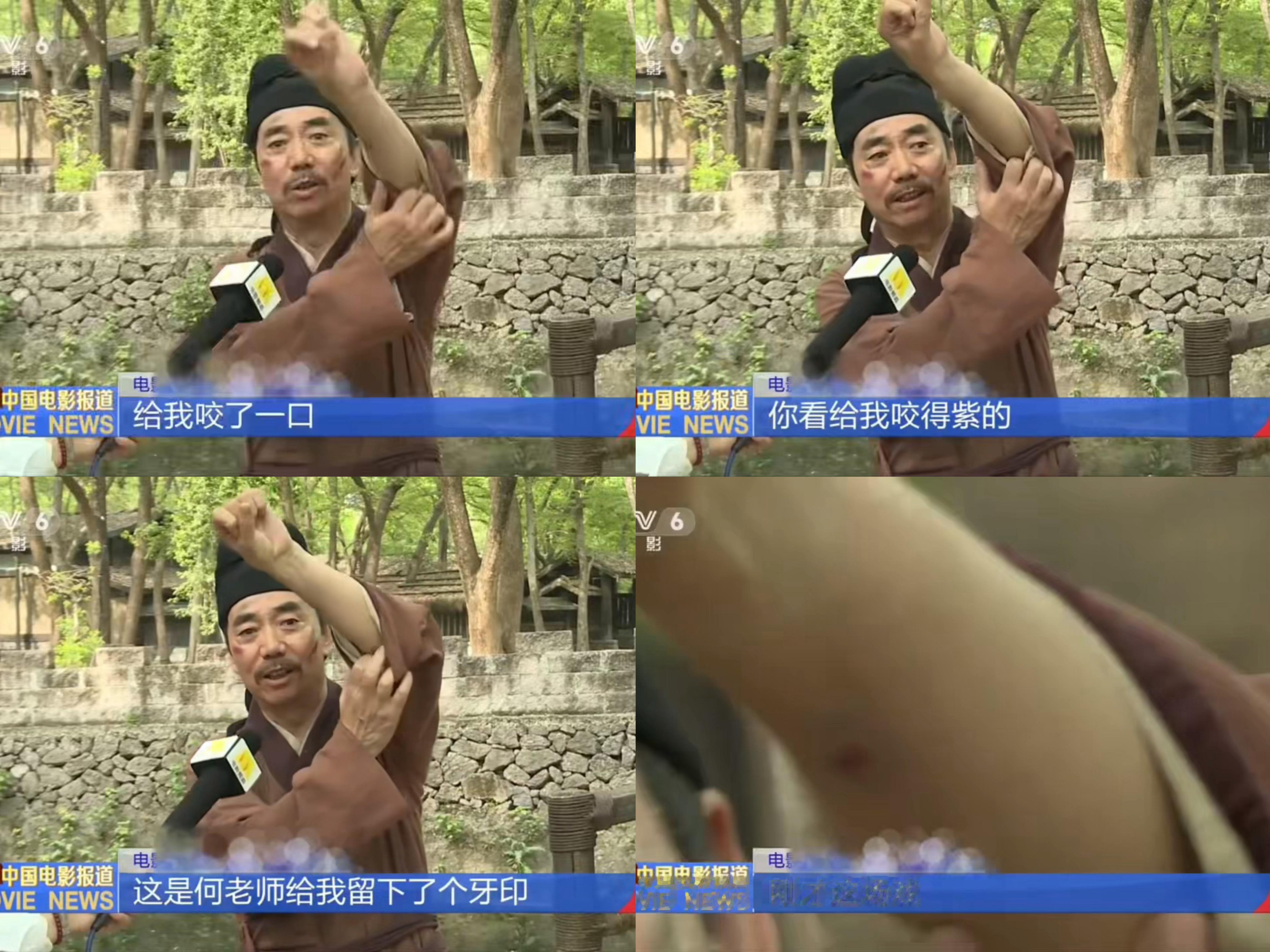 何赛飞把范明手臂咬紫了何赛飞把范明手臂咬了一排牙印为拍出真实有张力的戏份，何赛飞