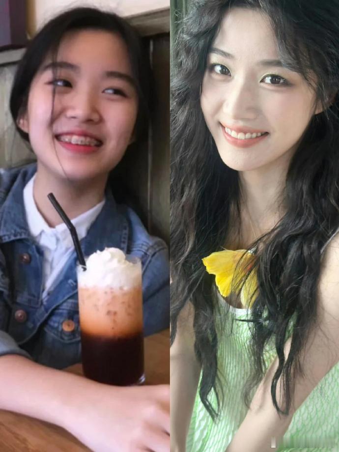 上海人这么重视小孩的牙齿矫正吗？  
