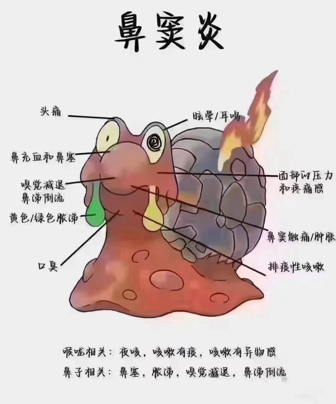 #中医##育儿专家说# 💍鼻窦炎六大表现①持续性流涕。②慢性鼻阻塞。③鼻后孔分