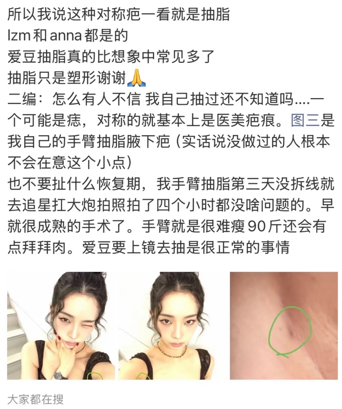 如何看待柳智敏anna被指都去胳膊抽脂了 ​​​