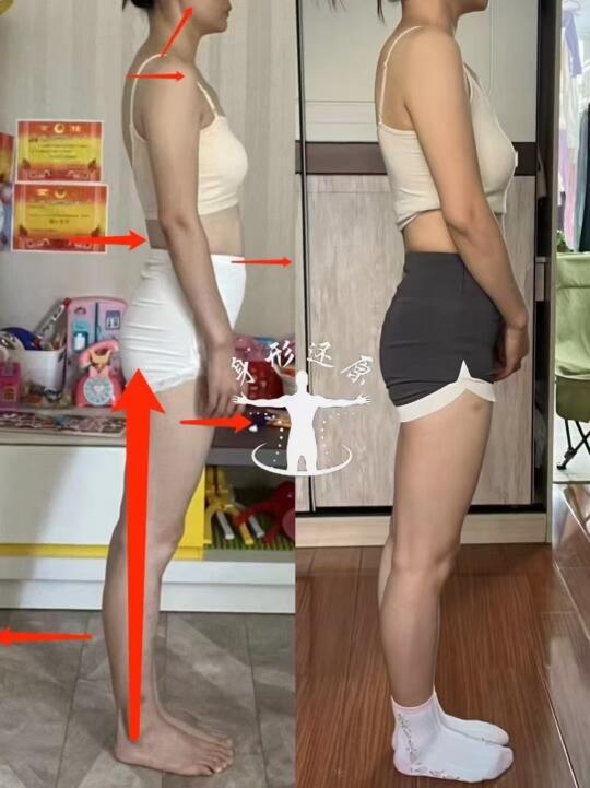 整体体态力线紊乱，那都需要调整
