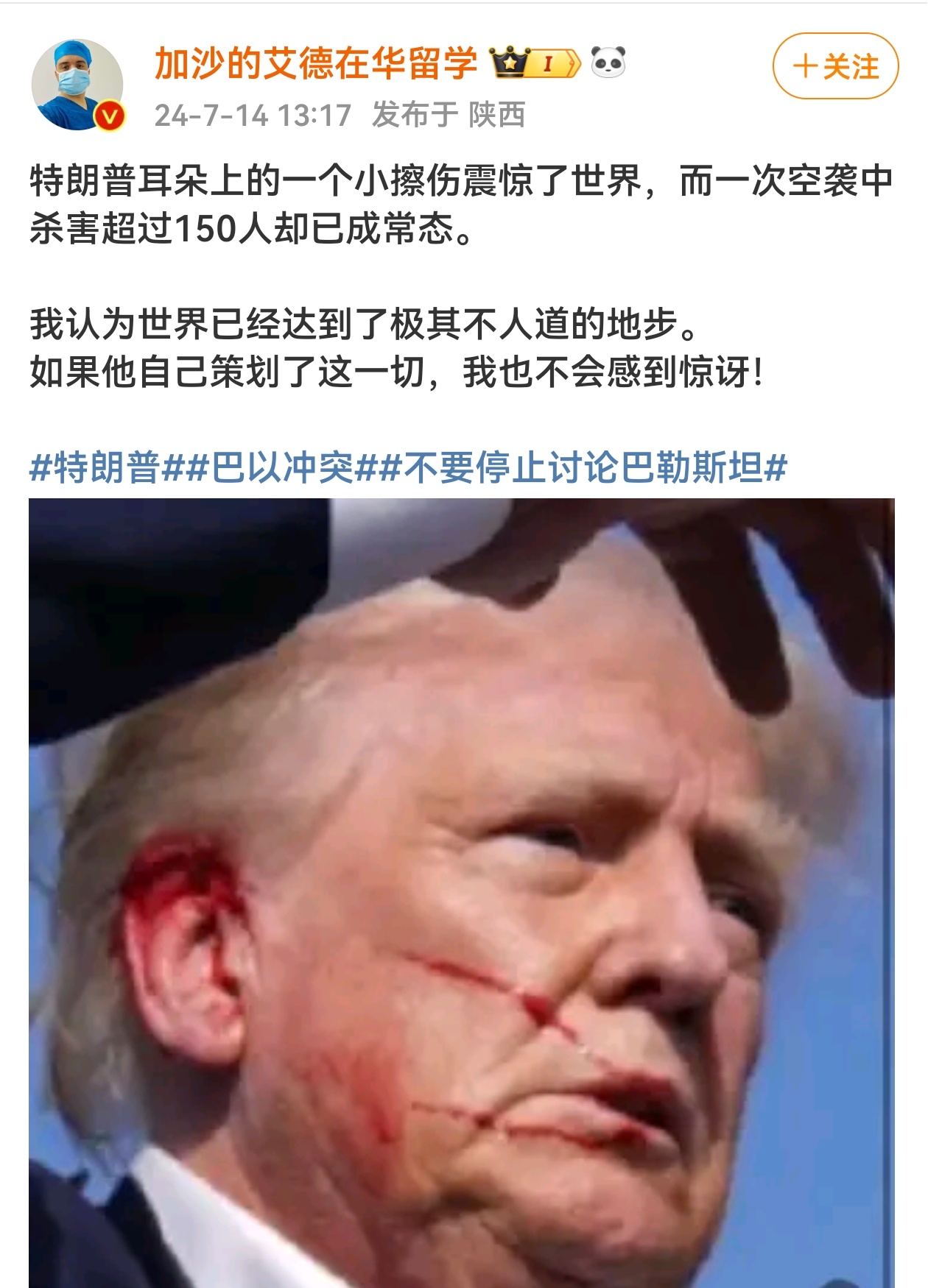 特朗普耳朵遮蔽了什么？特朗普上台对以色列更有利吗？射杀特朗普的凶手第一时间被击毙