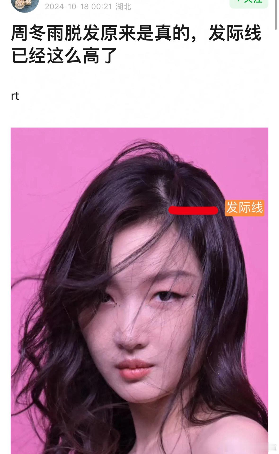 周冬雨 发际线被讨了 ​​​