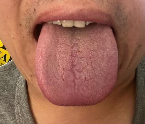 又是疏肝又是补肾，忽略了这一步，通通白费功夫
患者主诉：食欲不佳，那方面力不从心