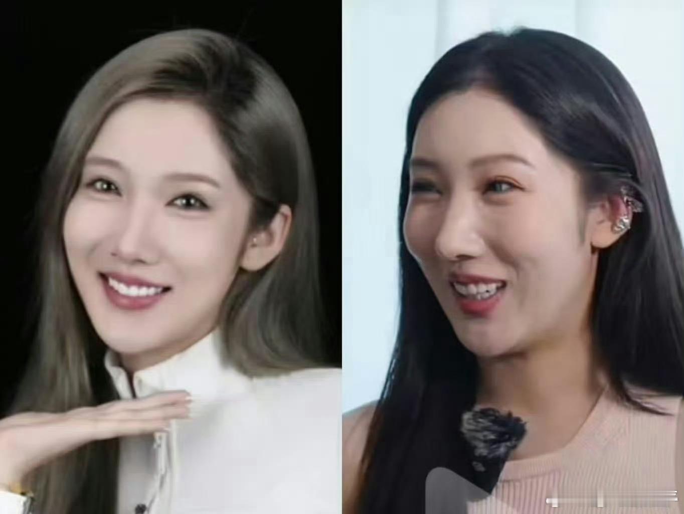 都美竹 医美好了好了 这下真坏了，其实人家有钱乐意整就整吧，与咱们无关 ​​​