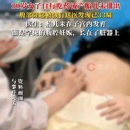 20岁女子药流后没复查，腹部隆起被强行送医才发现胎儿未排，医生：胎儿未在子宫内发
