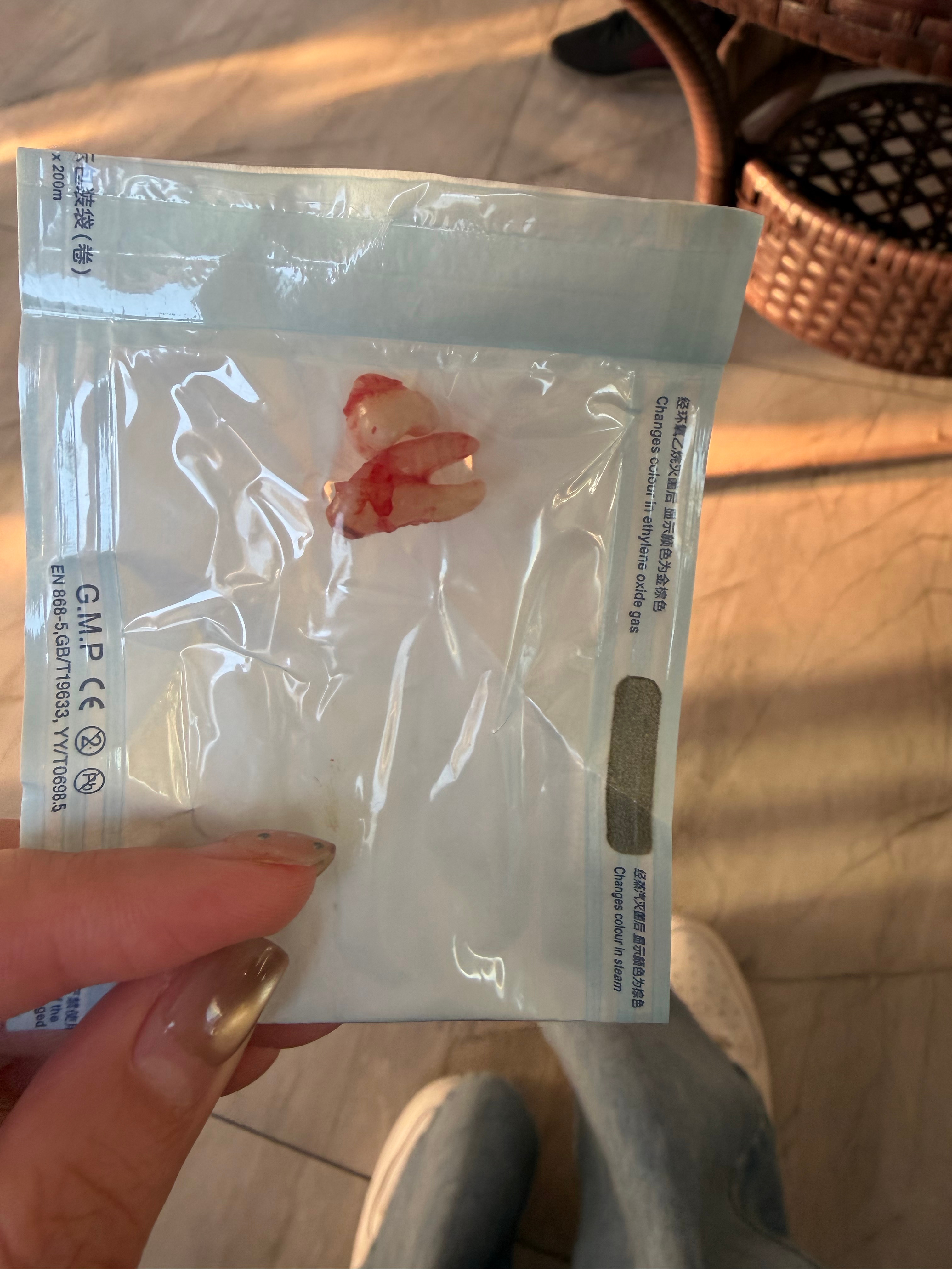 又拔了智齿