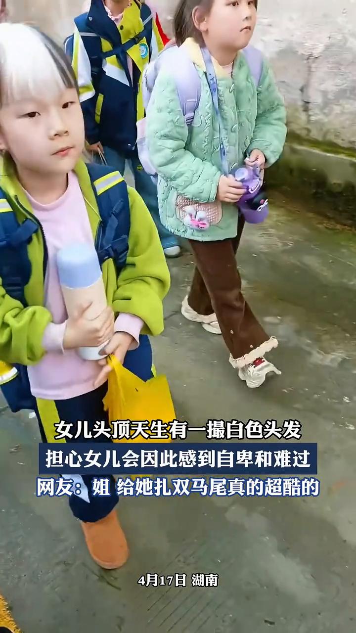 女儿头顶天生有一撮白色头发，担心女儿会因此感到自卑和难过。网友：姐给她扎双马尾真