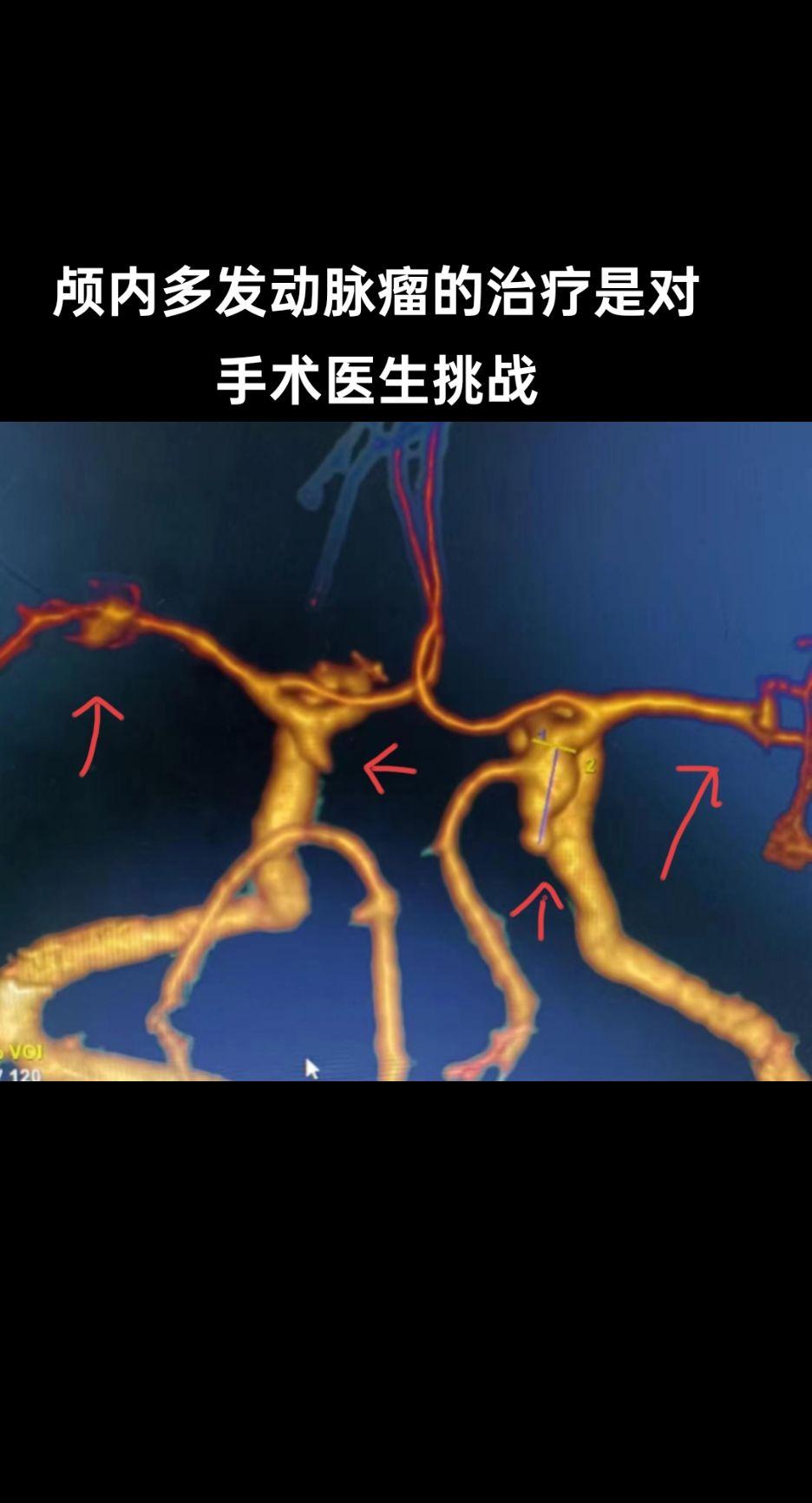 医学科普 医学影像 抖医医生