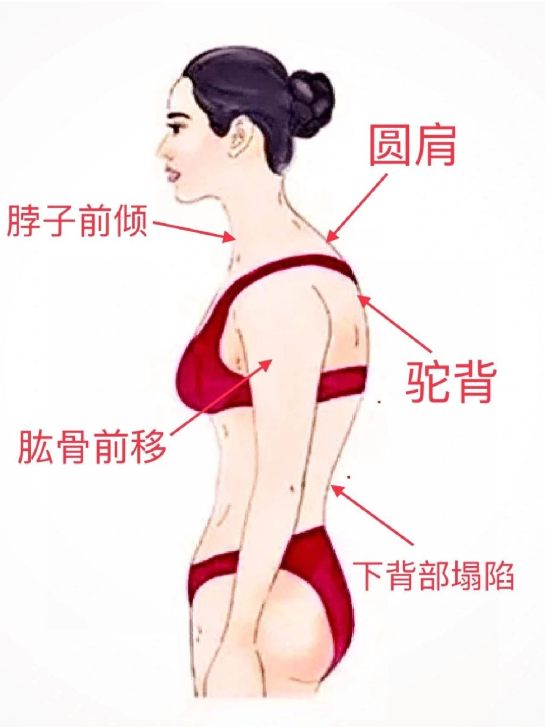 真心建议！这种体态真的好改善