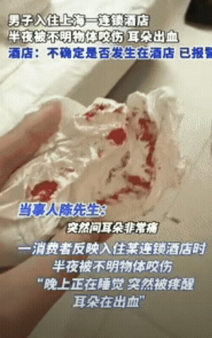 倒大霉了！
上海大哥住酒店睡梦中被啃耳朵
一摸全是血，结果酒店居然说

“不一定