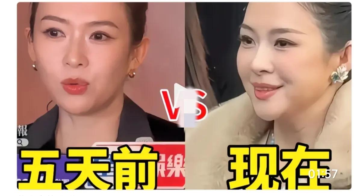 五天前的章子怡还跟以前长得一模一样，五天后再看到，整个人都长得不像了，变化的太快