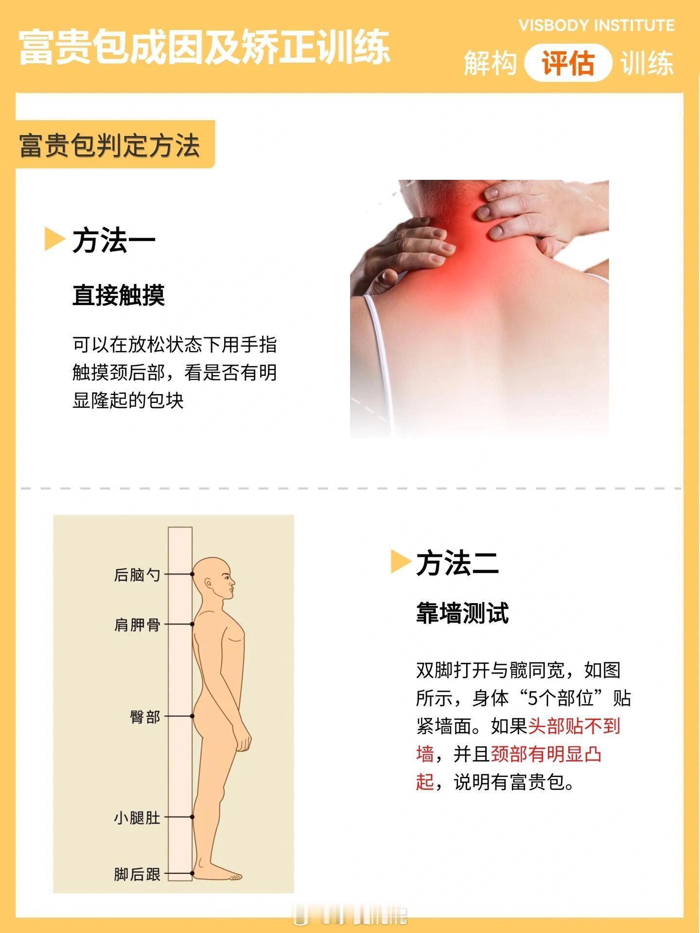 体态改善训练富贵包成因⏳矫正思路富贵包是一种不良体态的俗称颈后有个大包不仅影响我