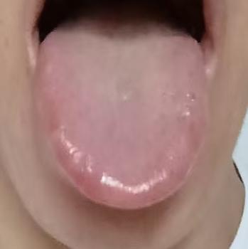 体内湿热蕴于下焦，常会出现下体潮湿、小便排泄不畅、情绪易怒等表现；中医调养讲究循