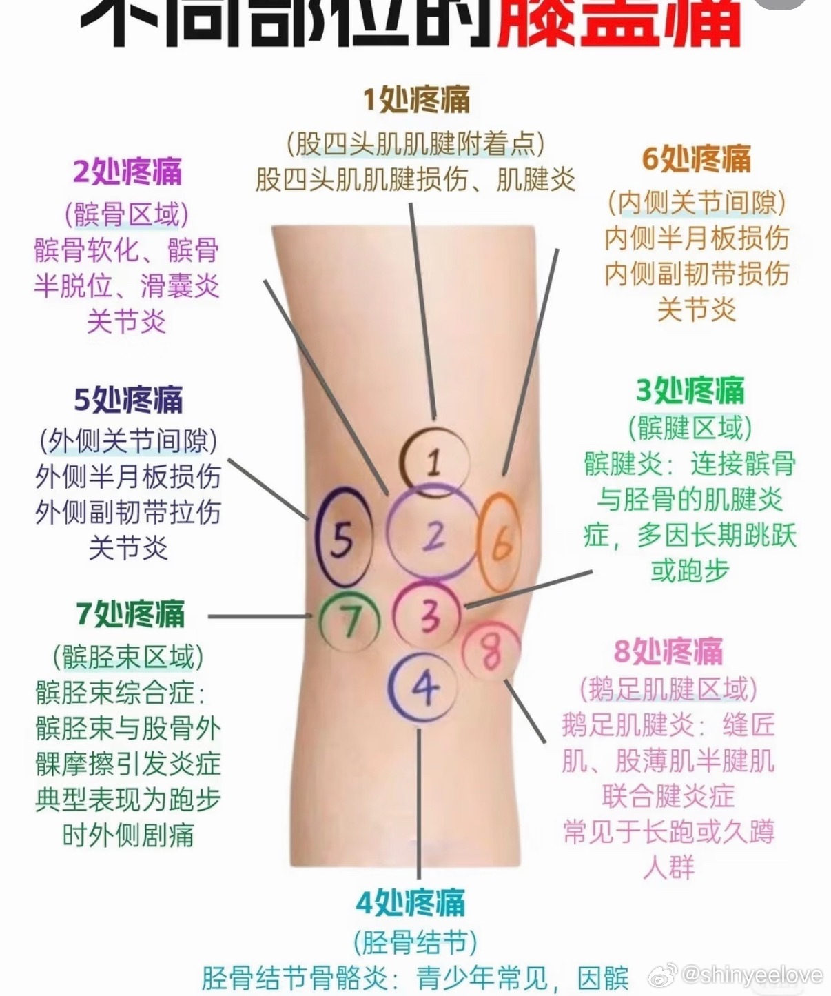 很多人低估了久坐对膝盖的伤害 久坐并非让膝盖休息，长时间屈膝会持续挤压关节，削弱