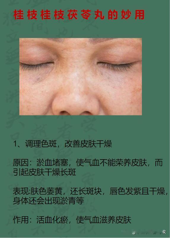 1个神奇的中成药：桂枝茯苓丸，胜过血府逐瘀，堪称血管“洗涤剂”，还可调理这5种病