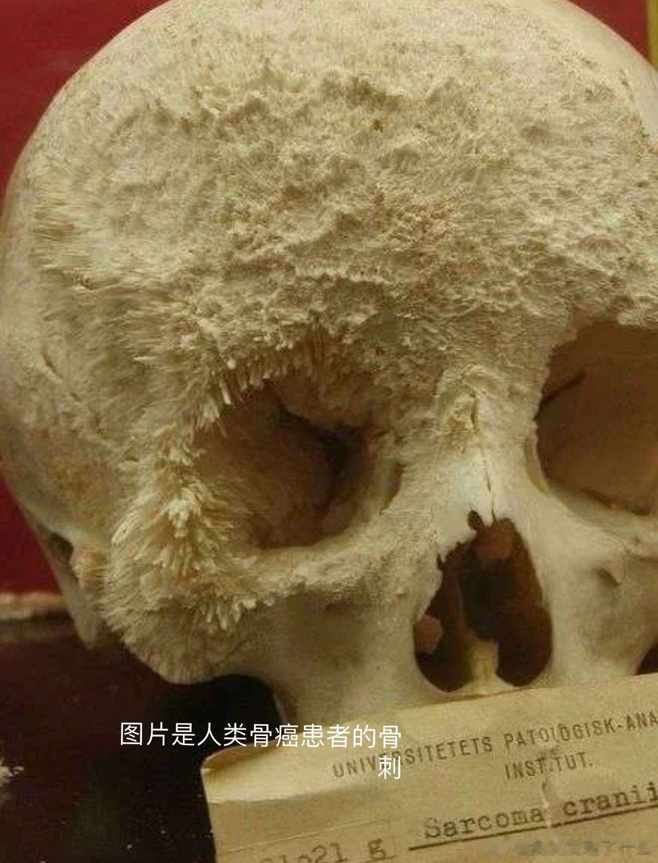 折耳猫发病后长骨刺的样子类似人类骨癌症状 ​​​