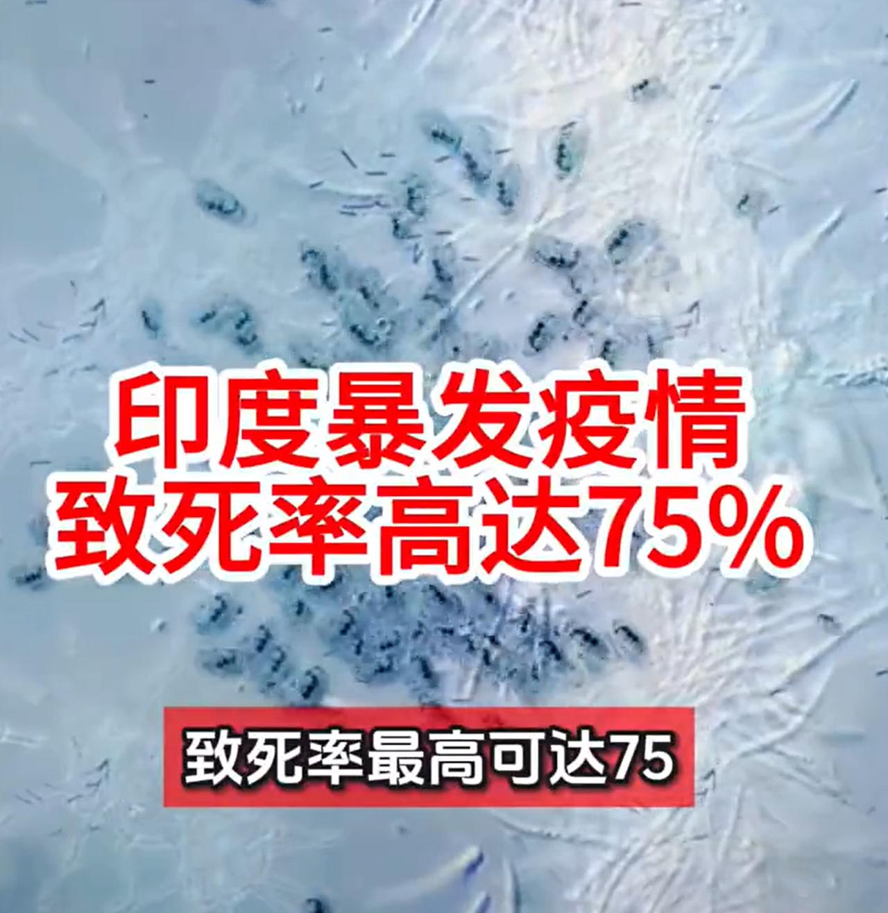 印度这次的病毒，致死率太高了，一定要严防死守，不能让传到我们这。

三个月前，我