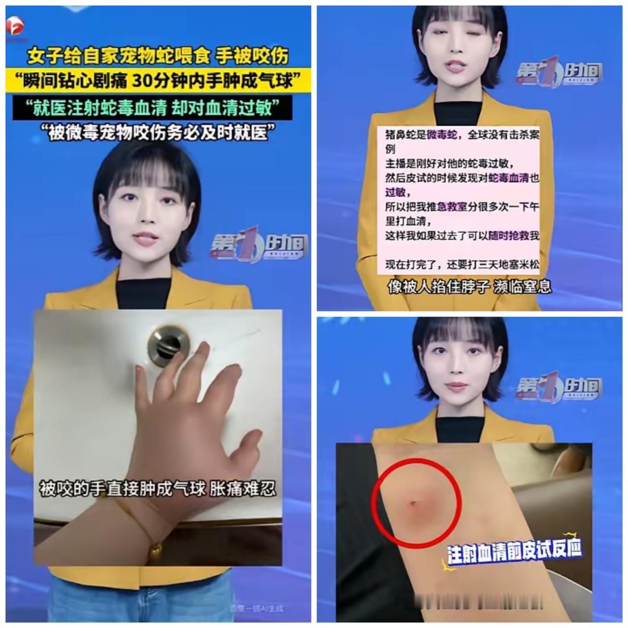 真的太吓人了！江苏一女生养宠物猪鼻蛇，居然连续快一个月没喂食，饿到发疯的蛇闻到她