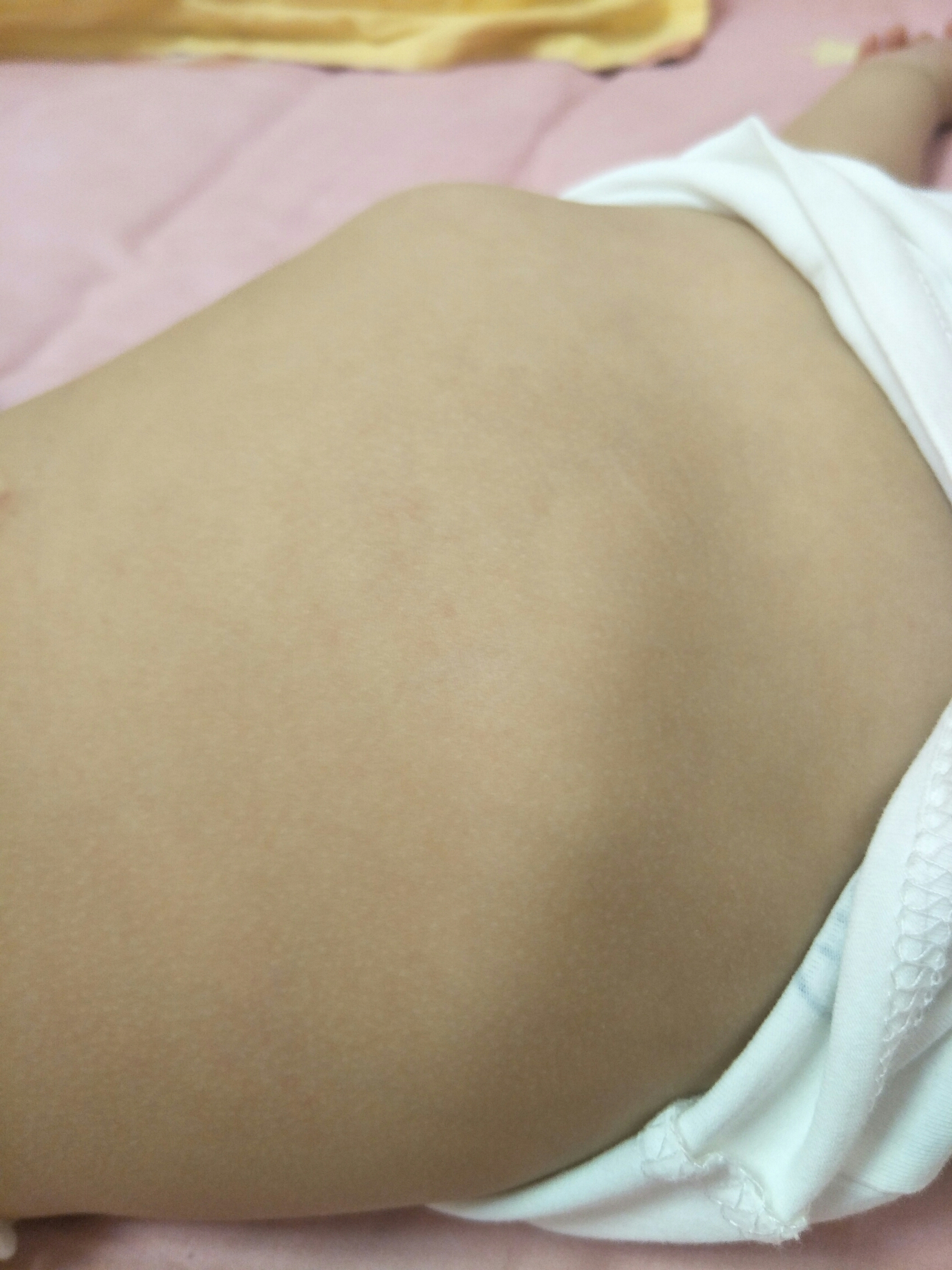 肋骨外翻是缺钙导致的吗？#儿童健康守护计划#  大概率不是，宝宝肋骨外翻大多是生