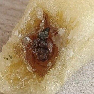 脆升升薯条吃出苍蝇的新闻，把零食安全这个老生常谈的话题又推到台前。四川网友吃了大