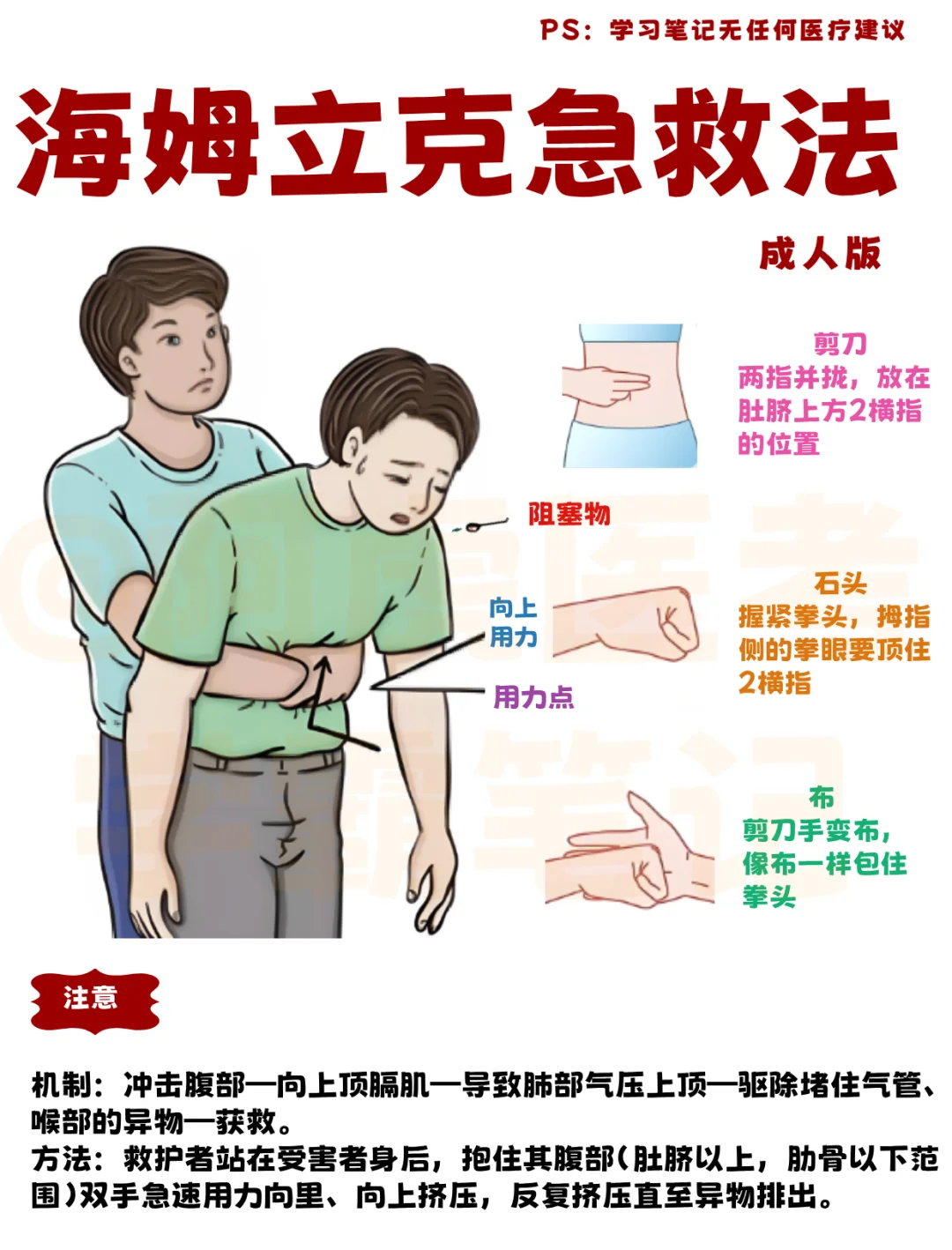 医学生笔记📒｜简单版海姆立克急救法👆