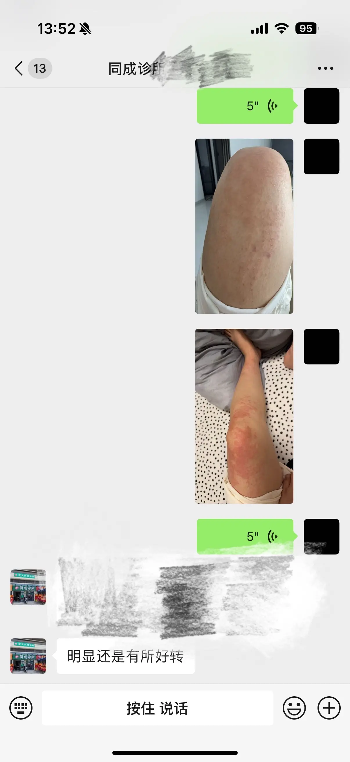 吃了一个榴莲干成这样，真的没谁了
